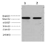 AFP alpha 1 Fetoprotein Monoclonal Antibody