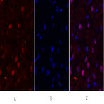 FAK Polyclonal Antibody