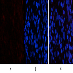 PDGF-B Polyclonal Antibody