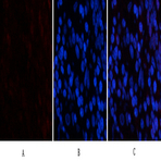 PDGF-B Polyclonal Antibody