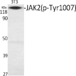 JAK2 (phospho Tyr1007) Polyclonal Antibody