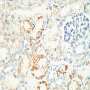 Ki 67 Monoclonal Antibody