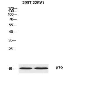 p16 Polyclonal Antibody