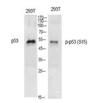 p53 (phospho Ser15) Polyclonal Antibody