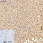 Carcinoembryonic Antigen Monoclonal Antibody