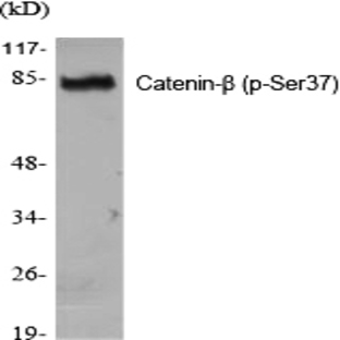 Catenin-? (phospho Ser37) Polyclonal Antibody