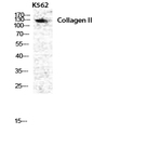 COL2A1 Polyclonal Antibody