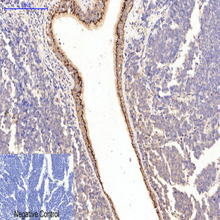 Collagen I Mouse Monoclonal Antibody(4H10)