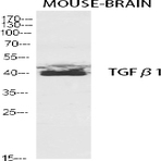 TGF?1 Polyclonal Antibody