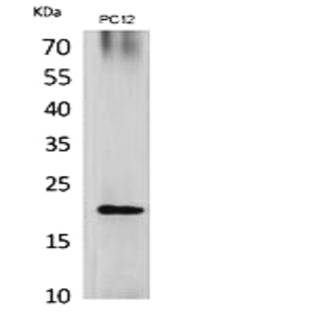 VEGF-B Polyclonal Antibody