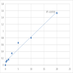 Human Tartrate-resistant acid phosphatase 5b (TRACP-5b) ELISA Kit