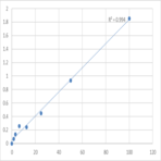 Human Palmdelphin (PALMD) ELISA Kit